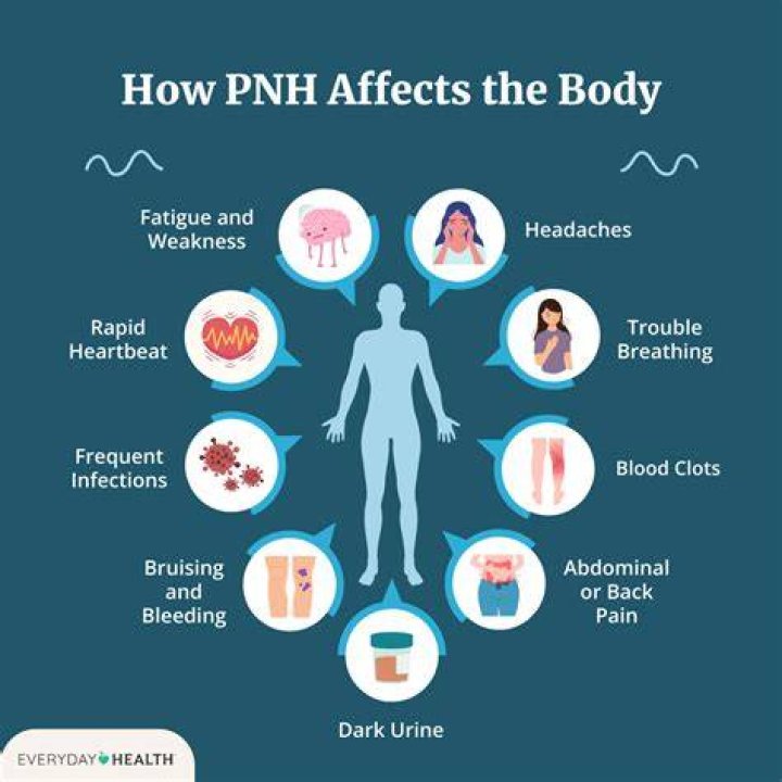 Is PNH an autoimmune disease