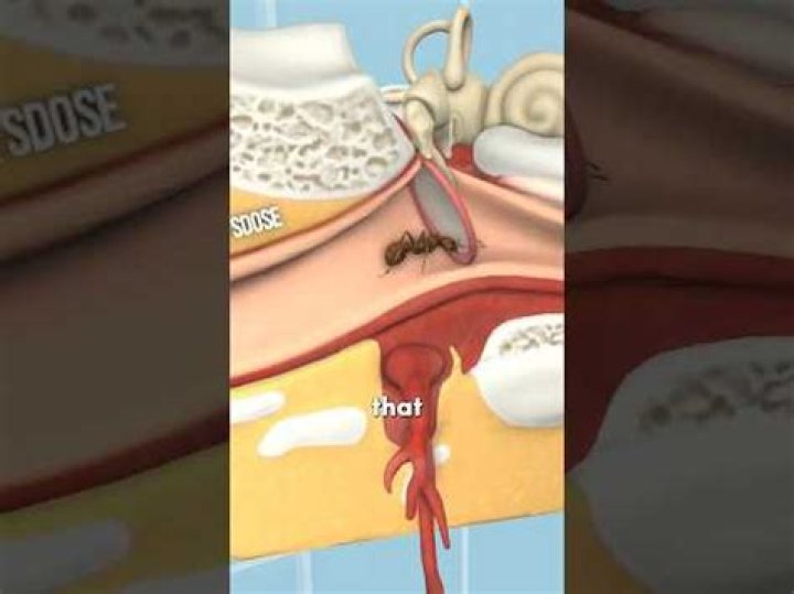 What happens if a bug flies in your ear