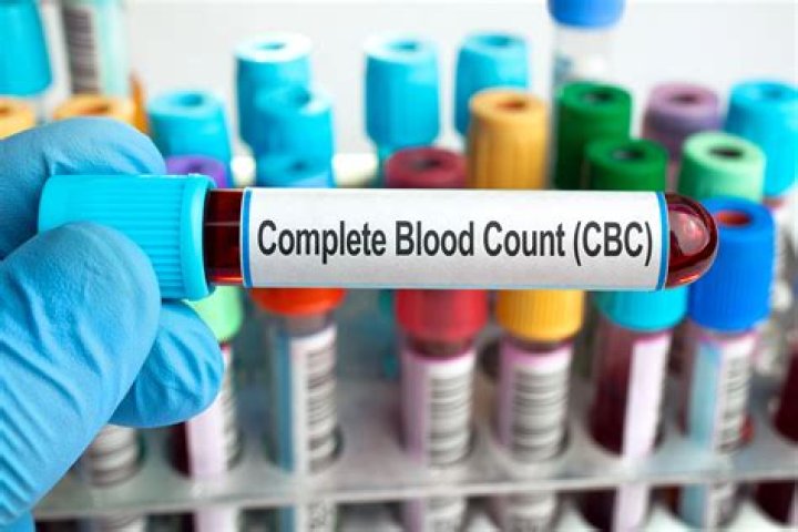 What is CBC test cost